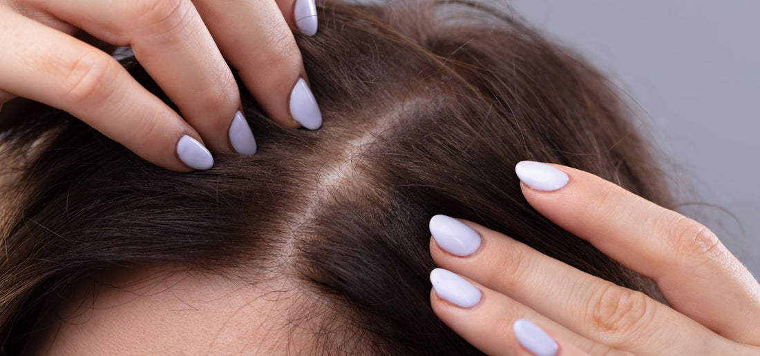 Weak Hair Roots: Causes, Symptoms & Treatment