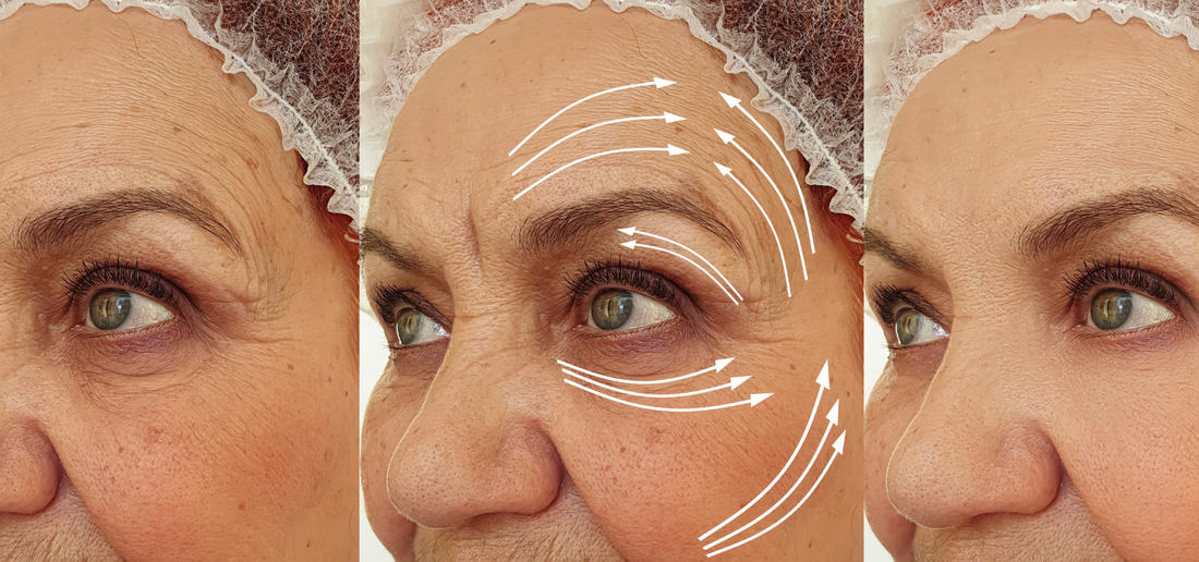 Wrinkles 101: Why They Form & What Actually Helps Reduce Them