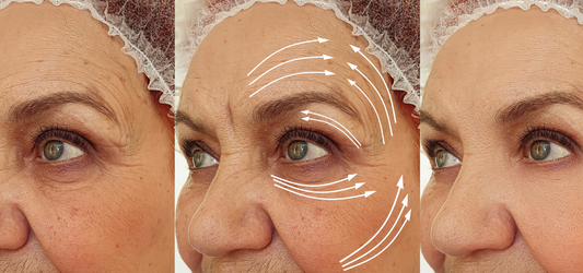 Wrinkles 101: Why They Form & What Actually Helps Reduce Them