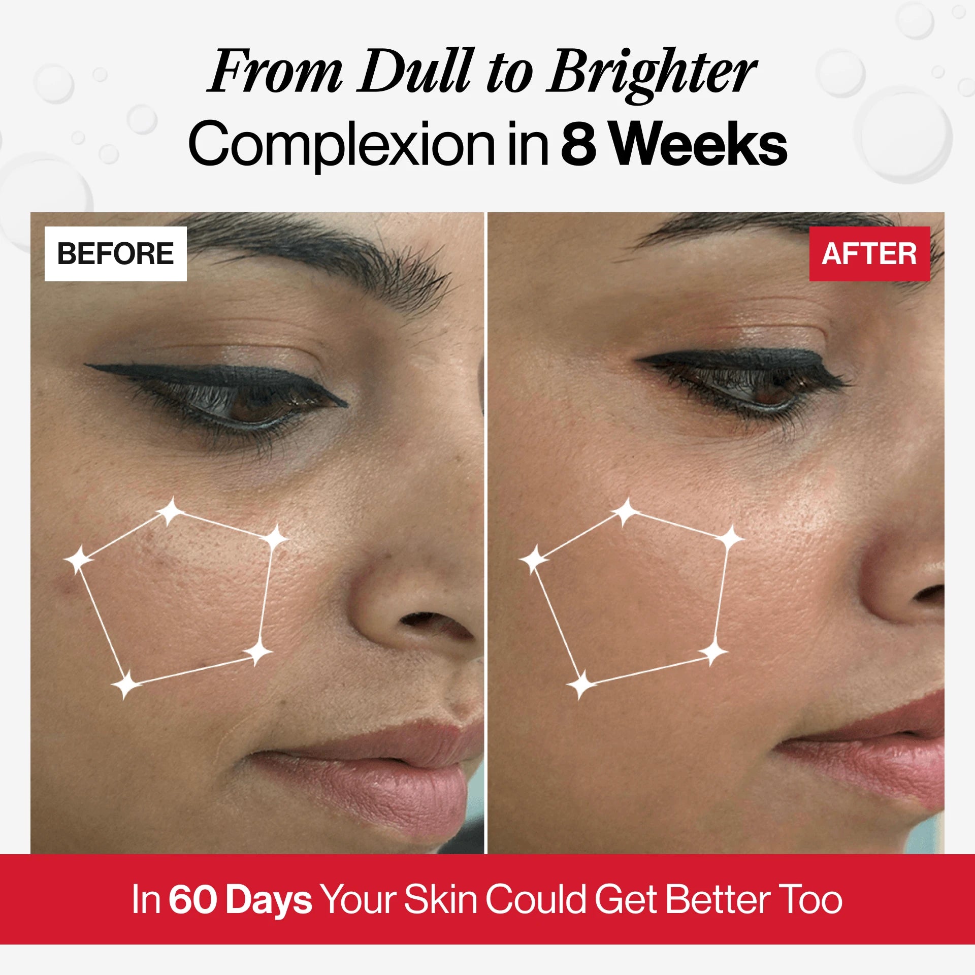 glutathione permanent is glutathione permanent Glutathione Before and After in Los Angeles glutathione permanent is glutathione permanent Glutathione Before and After in Los Angeles